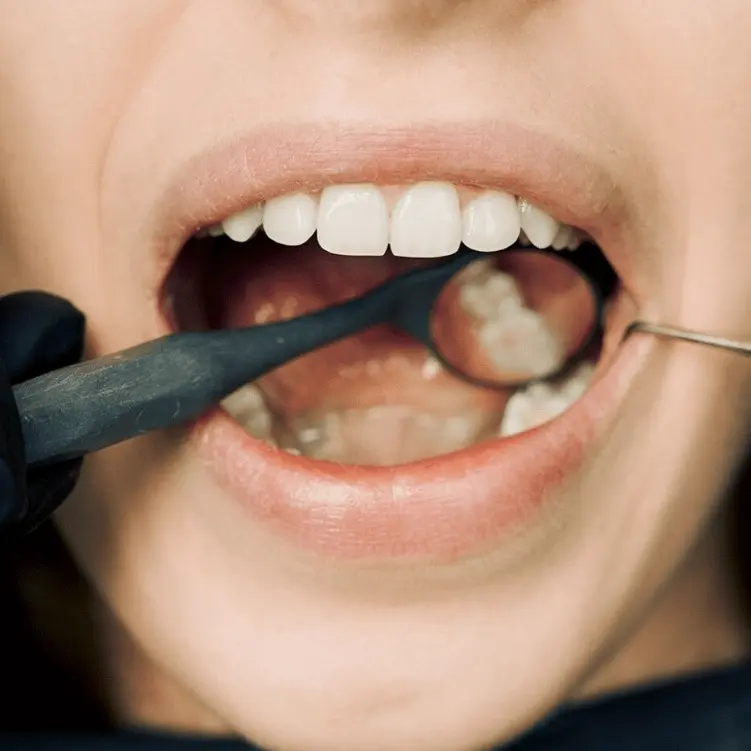 Root Canal Treatment Hq Dental Georgetown tx-min