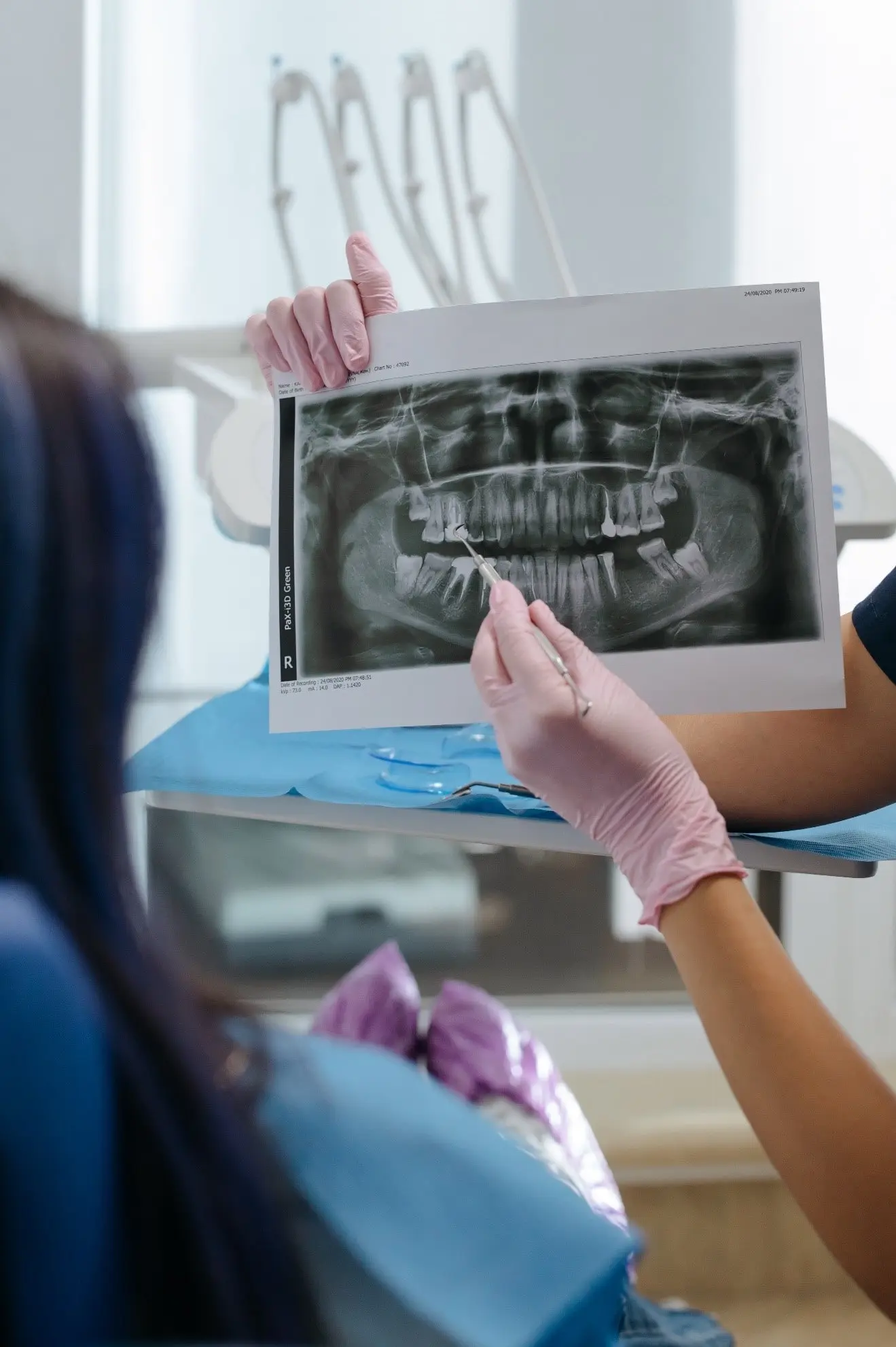 Overcoming Apprehensions About Root Canal Treatment Temple TX Dental