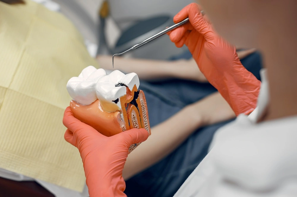 Tooth Decay Process How Fast Do Cavities Form