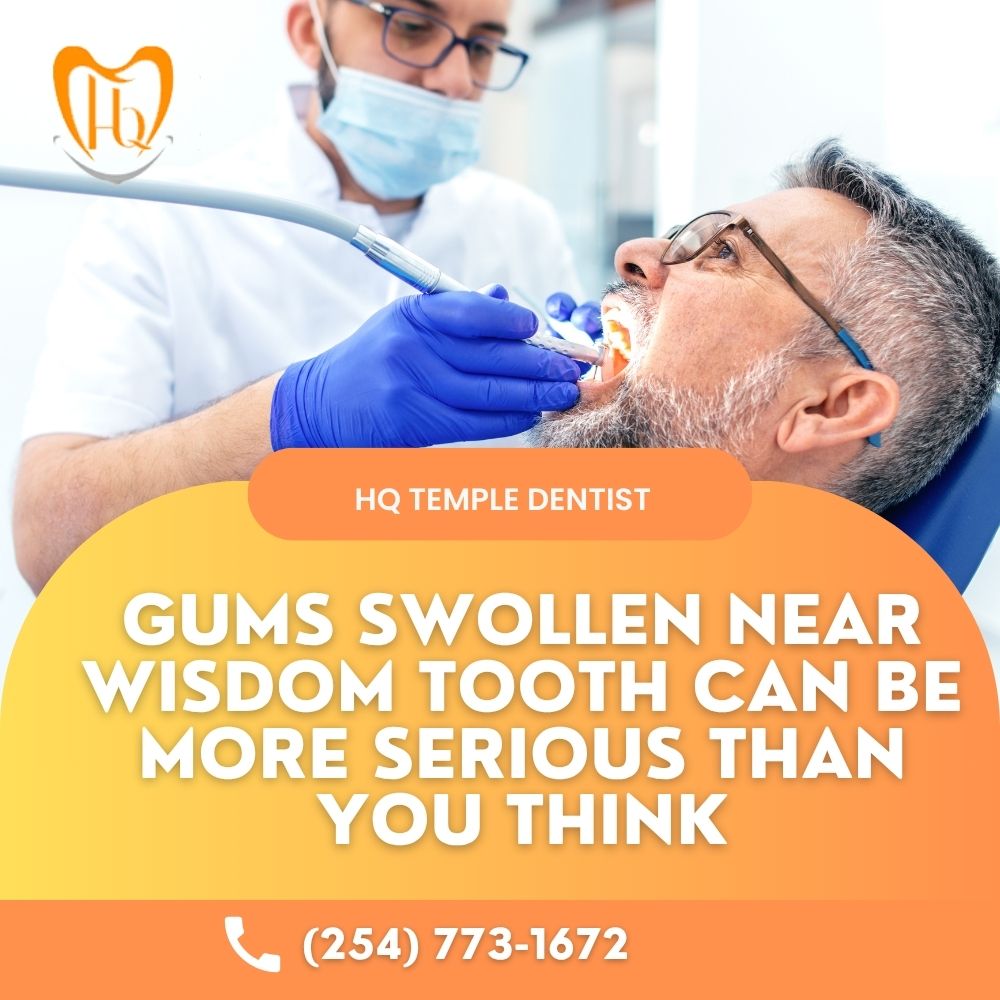 Gums Swollen Near Wisdom Tooth Can Be More Serious Than You THink