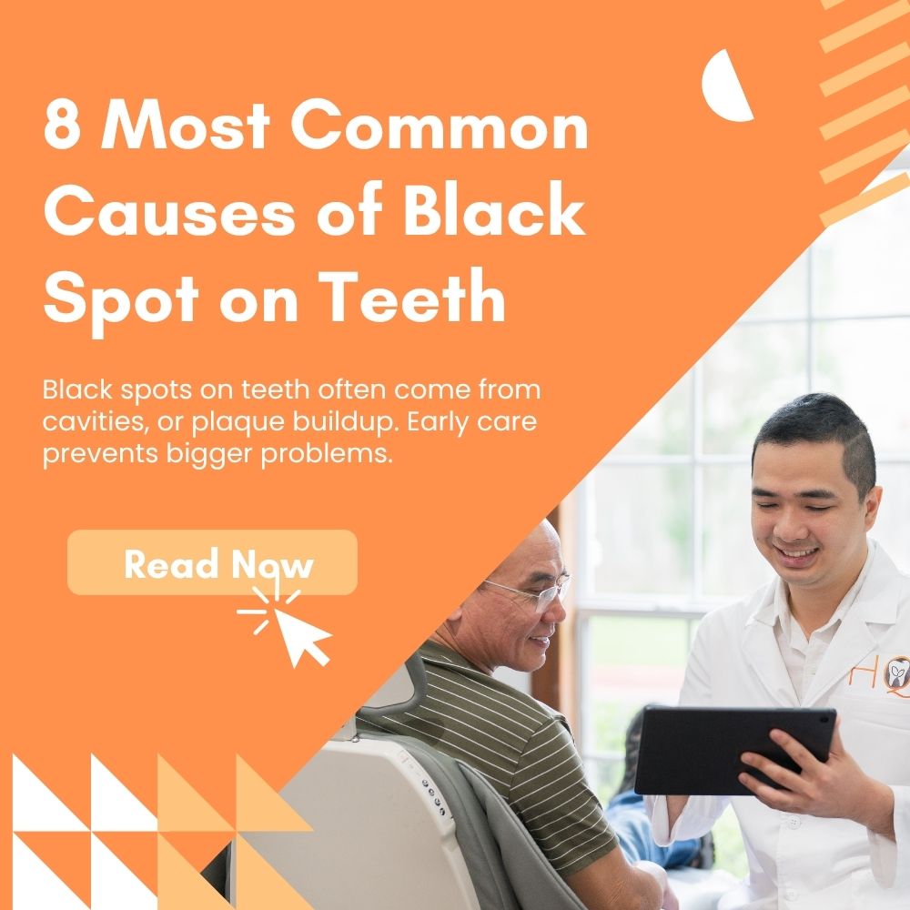 8 Most Common Causes of Black Spots on Teeth