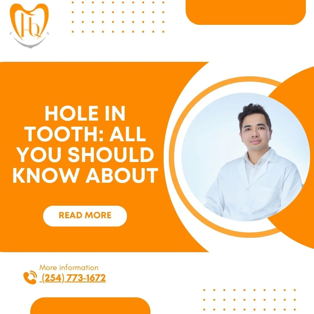 Hole in Tooth All You Should Know About