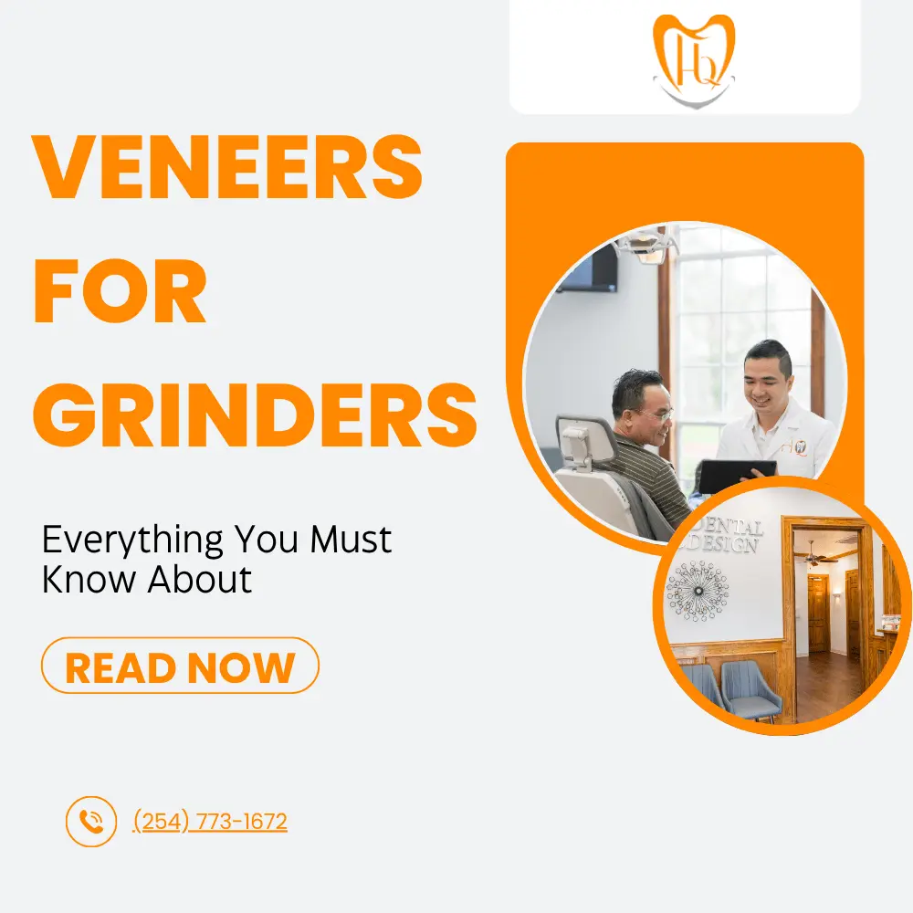 Veneers for Grinders: All You Should Know About