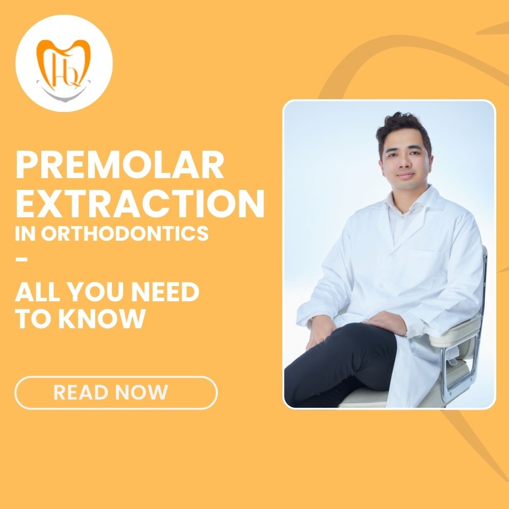 Premolar Extraction in Orthodontics
