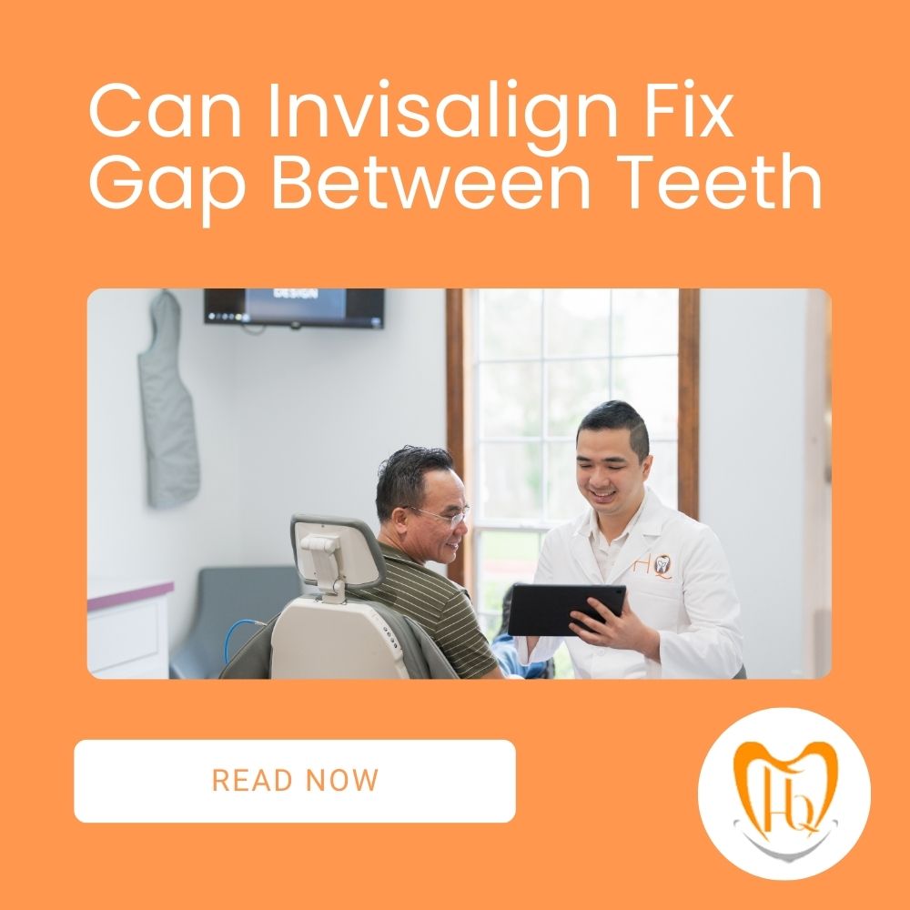 Can Invisalign Fix Gap Between Teeth