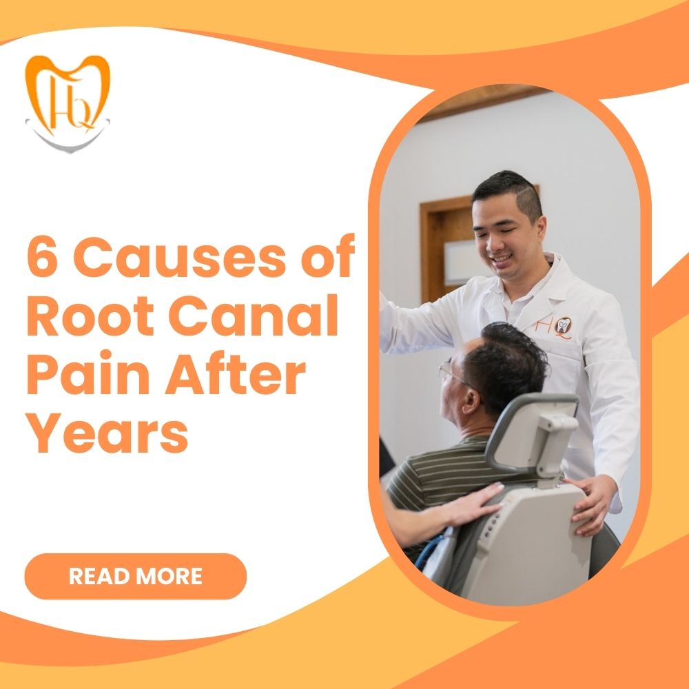 6 Causes of Root Canal Pain After Years