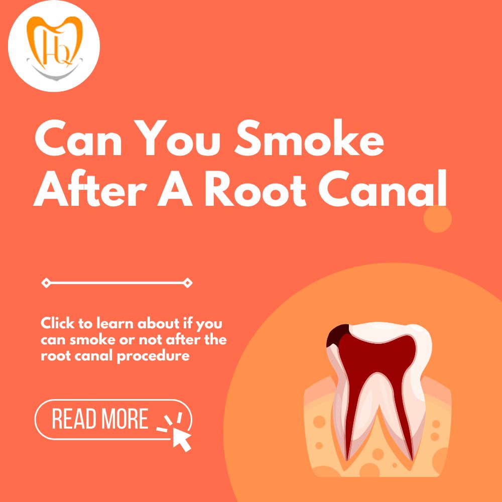 Can You Smoke After A Root Canal