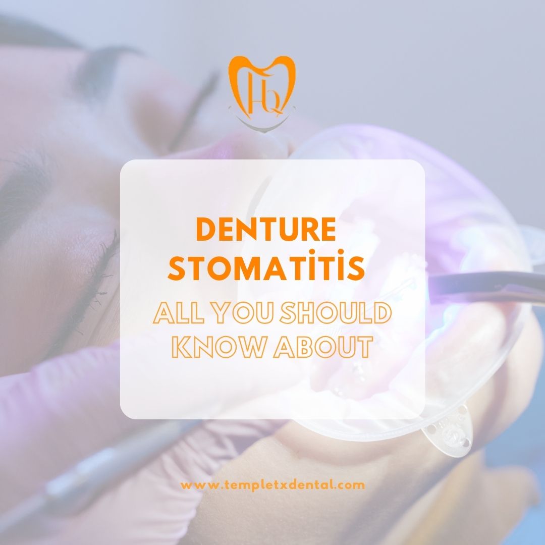 Denture Stomatitis