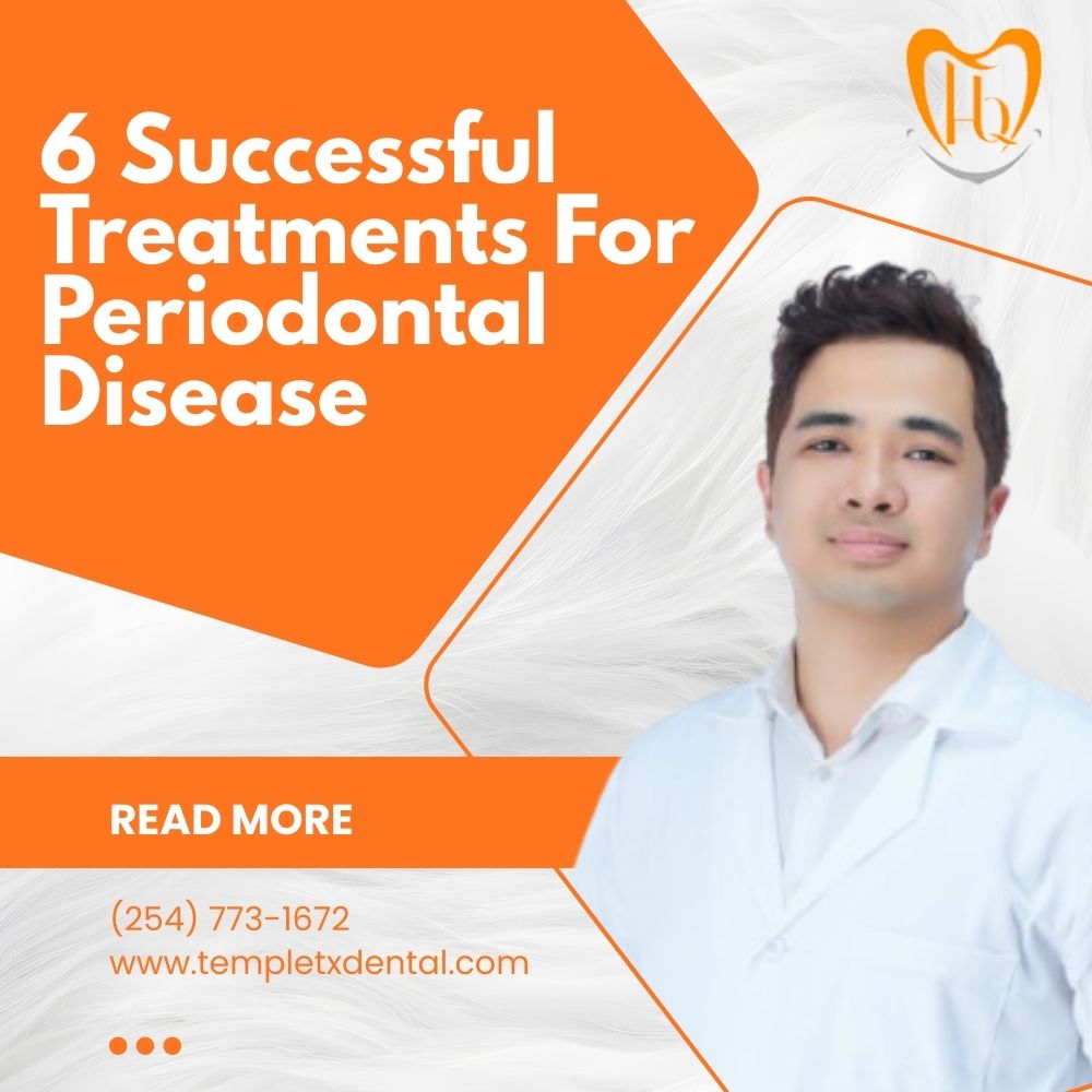 Treatments For Periodontal Disease