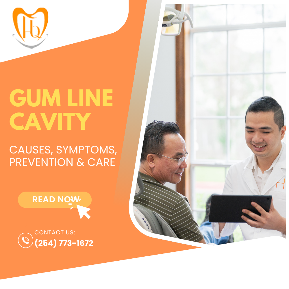 Gum Line Cavity