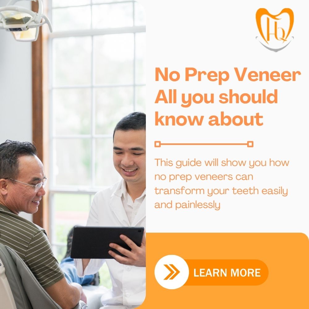 No Prep Veneer