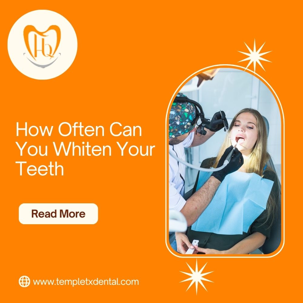 how often can you whiten your teeth