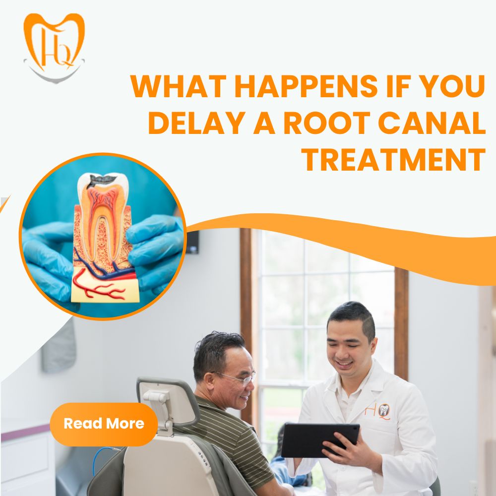 What Happens If You Delay a Root Canal Treatment