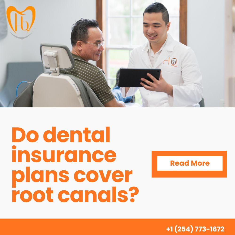 Dental Insurance Cover Root Canals