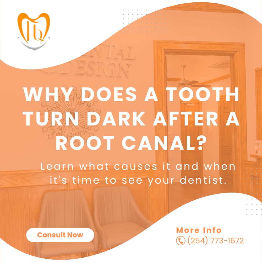 Why Does a Tooth Turn Dark After a Root Canal